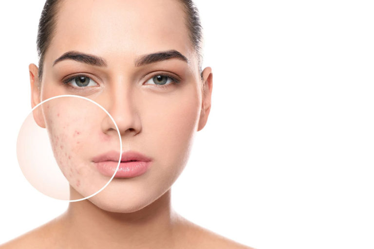 Blog 7 Clear Smooth Skin